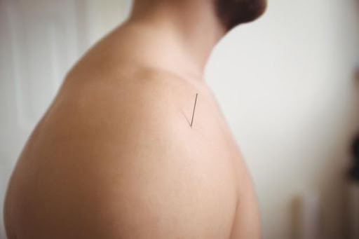 Can Acupuncture Help with Shoulder Pain?